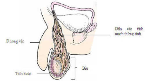 Giãn tĩnh mạch thừng tinh